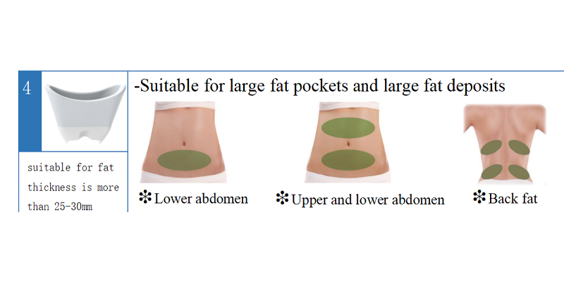 Cryolipolysis Machine